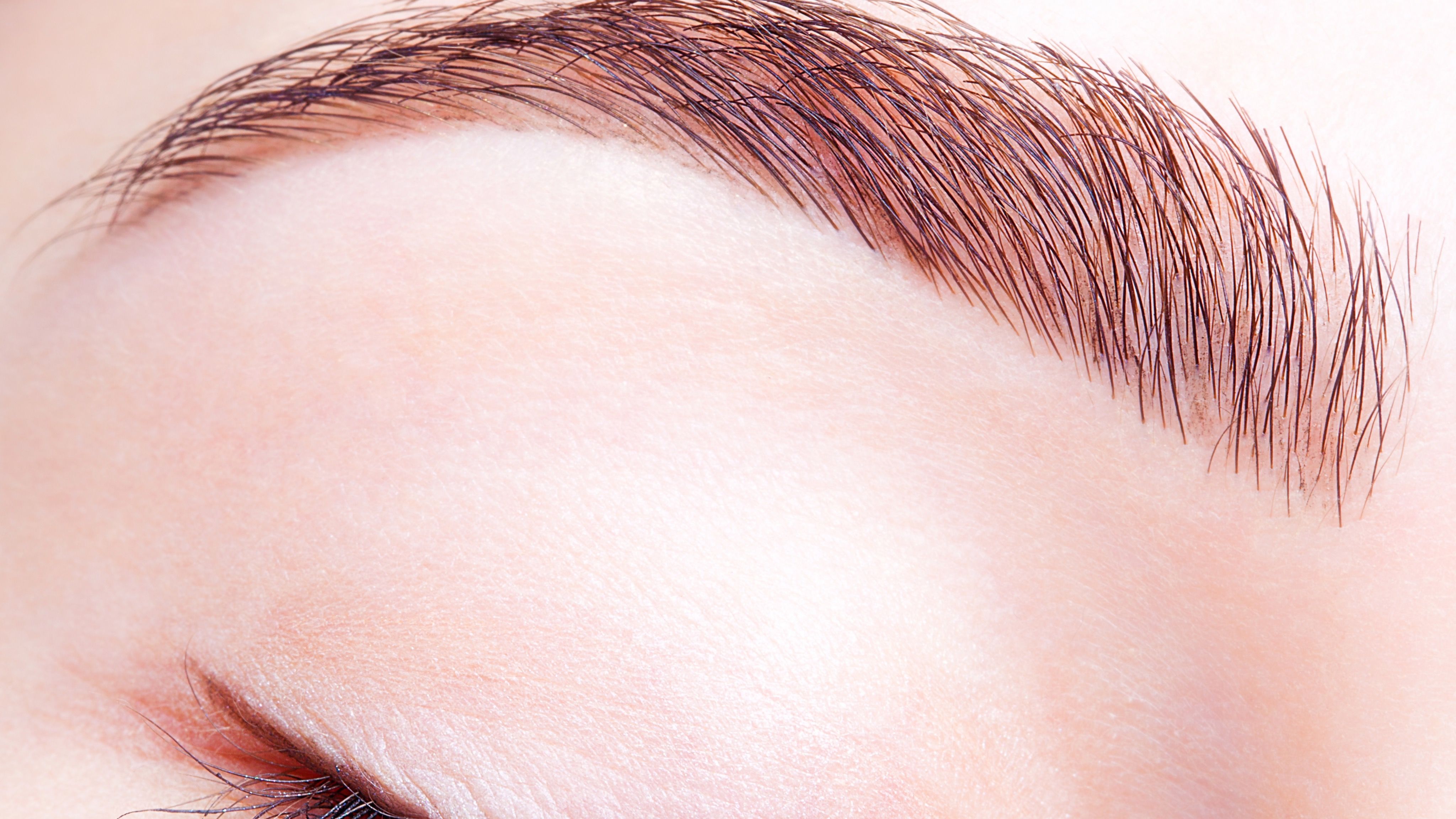 Brow lift